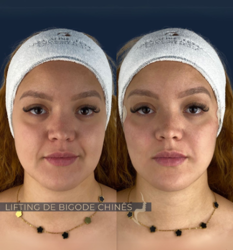 Design sem nome (10)